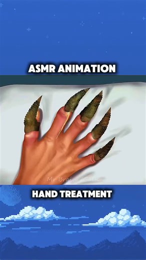 Hand Cleaning and Treatment ASMR Animation Experience