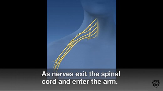 4.3K views · 97 reactions | Severe damage to the brachial plexus­ — the group of nerves that control the movements of your hands, arms and wrists­­­ — can leave your entire hand and arm paralyzed. Dr. Shelley Noland, a Mayo Clinic hand and peripheral nerve surgeon, has more on surgical options to treat brachial plexus injuries. https://mayocl.in/3eeQiJY | Mayo Clinic | Facebook