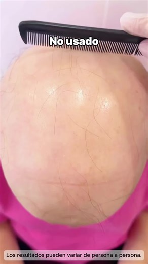 Champú para el crecimiento del cabello que enamora