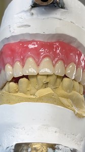 10K views · 75 reactions | Denture Prototype! Case from Dr. Greg Scheier in New Jersey! Scheier Dental Group | Luke Kahng | Facebook