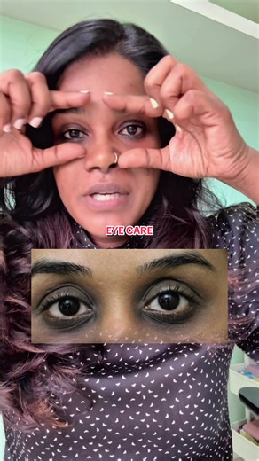 Effective Eye Care Tips to Reduce Dark Circles