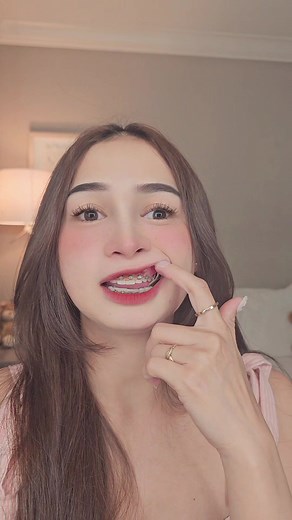Braces Update: What To Expect When Getting Braces