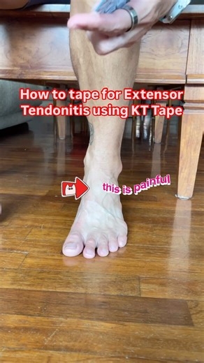 Lim Ee-Van on Instagram: "KT Tape: Extensor Tendonitis Pain on top of your foot. A (another) non-training related injury sustained as I was trying to prevent a neighbour’s dog from attacking mine. One of the dogs may had stepped, hit or I could had hit the top of my foot in the scuffle. This causes pain when I tries to walk, but much less when I run. Facts: Causes of Extensor Tendonitis includes repetitive movements, bad fitting shoe, too tight lacing, running too fast, too long, too soon, too m