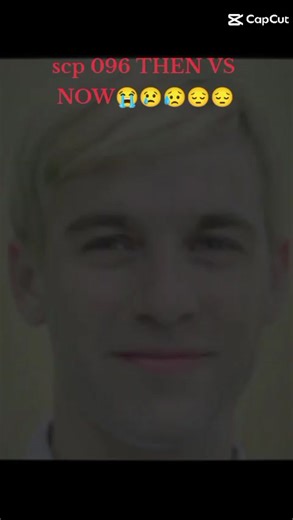 SCP 096 Real Face Transformation: Then Vs Now
