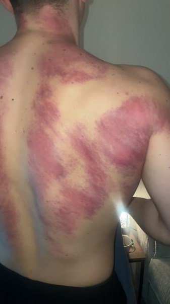 The Muscle Scraper on TikTok