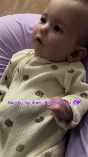 Moebius Syndrome Awareness Day: Let's Spread Awareness!