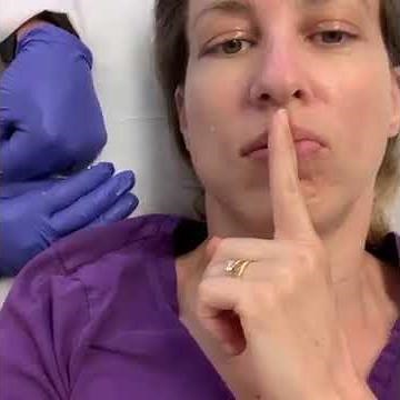 Mouth Puckering Exercises for Synkinesis