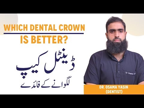 What is Dental Cap (Crown) – Dental Crown Kab Aur Kyun Lgwana Chahiye | Types of Dental Cap in Urdu