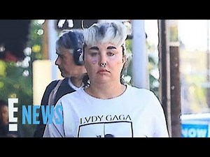 Amanda Bynes Reveals She Lost 28 Pounds With Ozempic | E! News