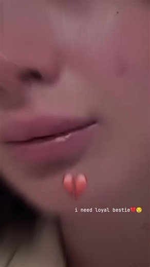 Find Your Loyal Bestie Today