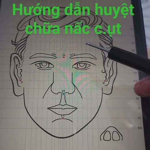 hướng dẫn huyệt chữa nấc c.ụt .. .