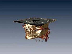 3D visualization of a head CT scan