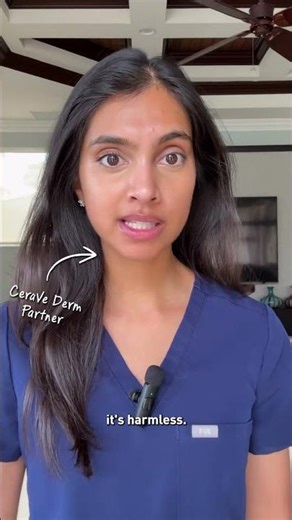 How to treat dandruff