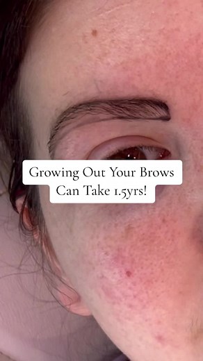 How to Grow Out Sparse Brows in 1.5 Years