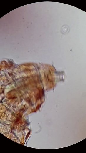 Exploring Waterbears Under the Microscope