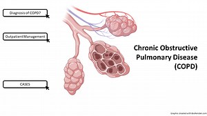 COPD - Outpatient Management