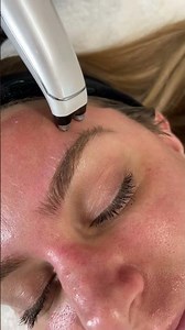 Microcurrent Therapy: Not Just a Trend, But a Real Solution for Wrinkles
