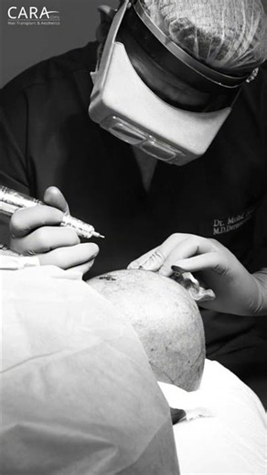 Hair Restoration in Seconds: The Grafting Process