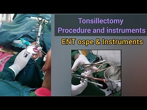 Tonsillectomy Thorat Surgery Instruments // ENT Ospe