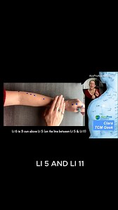 23K views · 733 reactions | Here is sneak peak in my made easy quick video on the 20 acupuncture points of the LARGE INTESTINE meridian. Want more: here's my post all about the TCM Large Intestine system: https://acuproacademy.com/tcm-large-intestine/ #largeintestine #meridians #acupuncturepoints #acupoints #tcmstudent #acupuncture | AcuPro Academy | Facebook