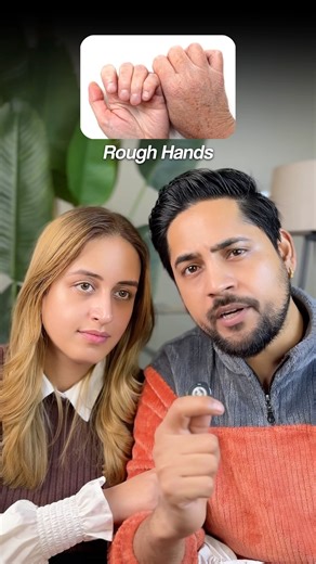 Dry Skin, Dandruff & Chapped Lips in Winter? Fix This ❄️ #diyskincare #winterskincare