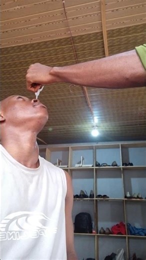 SUPER GLUE in the EYE PRANK 😲🙆#shorts