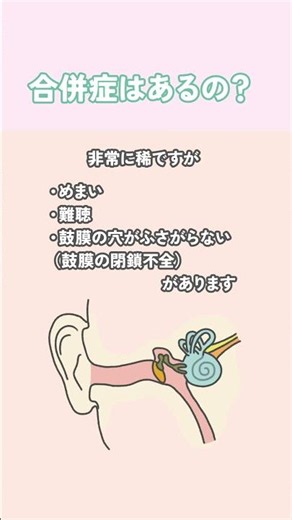 鼓膜切開について✨
