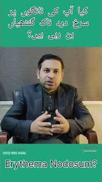 what is Erythema Nodosum? it's causes & treatment F.Aesthetics & Dermatology MD Skin Center