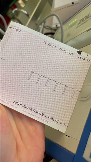Recorder Check for Zoll R Series Defibrillator