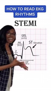 1.1K reactions · 274 shares | Here’s the basics of reading abnormal EKG rhythms! #nursesoftiktok #nursingstudent #nclexquestions #nclextips #nurseslife #nclexreview #nursingschool #nclexstudyguide #nclextips #nclexprep #registerednurse #lpn #lpnschool #nclexexam #nclexstudying #cna #anatomy #pharmacology #nclexhelp #anatomyandphysiology #nclexpn #ekg #ekgtips #ecginterpretation | NCLEX Success by Choosing Nursing | Facebook