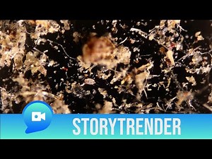 Bed Bugs Filmed Under Microscope