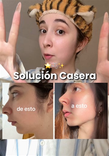Consejos de Soluciones Caseras para Definir el Rostro