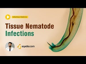 Tissue Nematode Infections | Medicine Lectures | Medical Student Online | Introduction