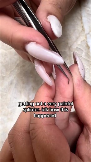  You won't believe what came out of this one... #pimplepop #satisfying | Armour Body | Facebook