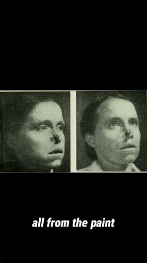 The Radium Girls: Poisoned for the Glow ⚠️