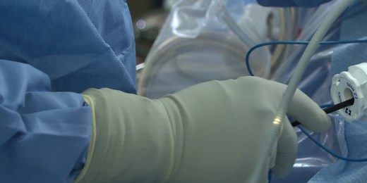 Medical Moment: First microwave ablation treatment burns away liver tumors