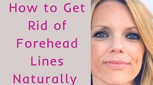 How to Get Rid of Forehead Lines Without Botox