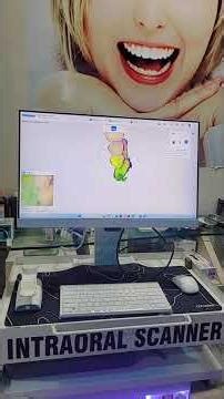 This is how our intraoral 3d scanner works @patildentalcarecosmeticden9049 #3dscanner