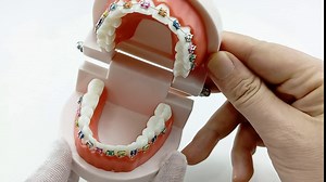 QWORK Typodonts Orthodontics Demonstration Model - Silicone Mouth Model, with Metal Wires and Brackets for Teeth Brushing Education