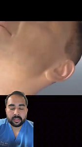 16K views · 184 reactions | Surgery for sleep apnea ; doctor explains | Inside Anesthesia | Facebook