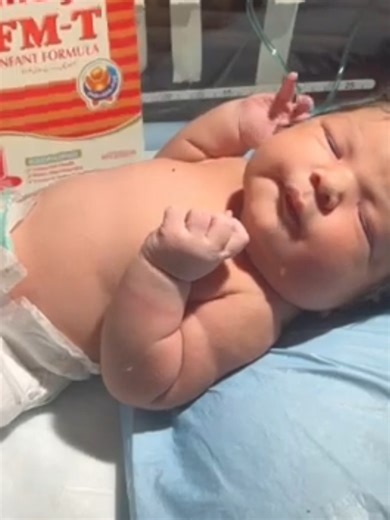 Newborn Baby Initial Check-Up in Delivery Room First Medical Examination After Birth | Today 2