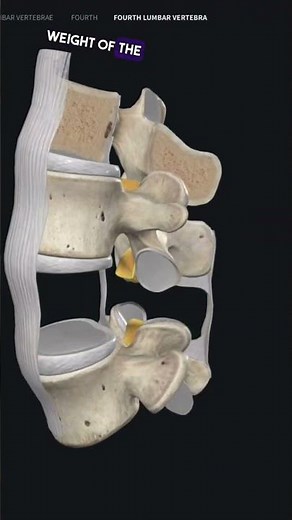 Ligamentum Falavum Hypertrophy