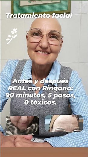 Tratamiento Facial en una sola Sesión/Antes y Después REAL con ringana: 90minutos/5Pasos/Tóxicos.