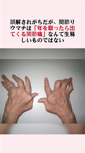 関節竜町についての理解を深める