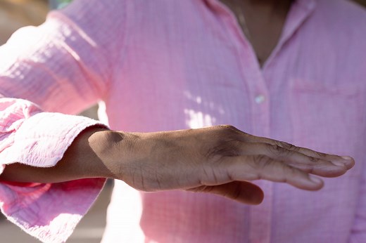 What Experts Want You to Know About Muscle Twitches