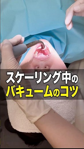 現役歯科衛生士が教えるバキュームのコツ【歯科医院】