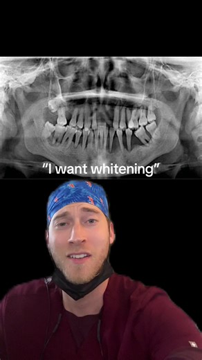 Teeth Whitening and Dentures Explained by a Dentist