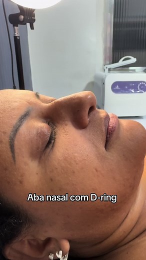 Aba nasal com D-ring: Experiência Rápida e Sem Dor