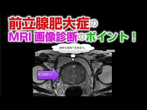 前立腺肥大症のMRI画像診断のポイント！