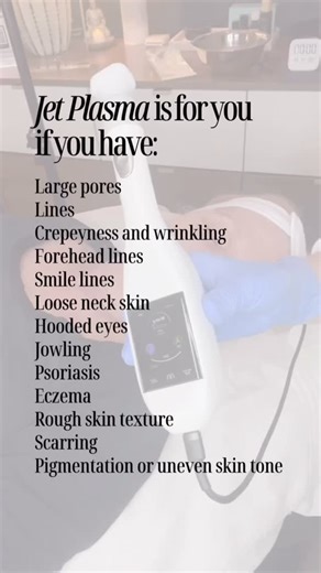Marcella | Non Surgical Anti Aging | Orlando on Instagram: "This Jet Plasma is cold atmospheric plasma that includes three plasma technologies in one, making it more effective than other plasma devices. It remodels the structure of the skin on a cellular level and has zero downtime. I’ve also been using it for hair restoration and body tightening. Would Jet plasma be good for your skin? DM me and let’s see. . . [jet plasma treatment orlando florida, noninvasive treatment, skin rejuvenation no do